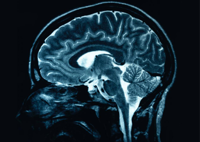 Tiene el Cinvestav nueva interpretación de causas del Alzheimer; una proteína mataría a las neuronas