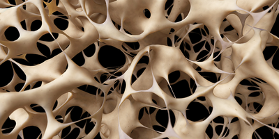 Ingenieros mexicanos crean dispositivo para detectar osteoporosis