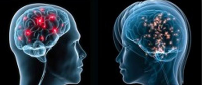 Mexicano desarrolla método para curar el Parkinson y Alzheimer