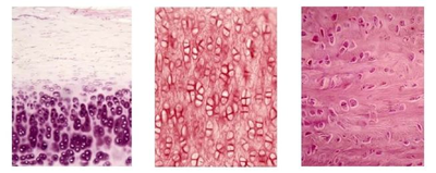 The pro-fibrotic connective tissue growth factor (CTGF/CCN2) correlates with the number of necrotic-regenerative foci in dystrophic muscle